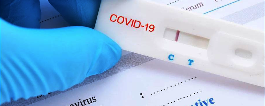 विदेशबाट नेपाल एयरलाइन्समा यात्रा गर्दा पीसीआर नेगेटिभ अनिवार्य